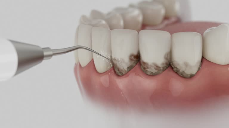 Reliable Dental Implants contractor in Sunset, UT by Smile Center Dentistry